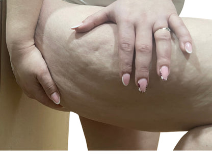 CELLULITE IS NOT THE PROBLEM - PREMIUM EDITION